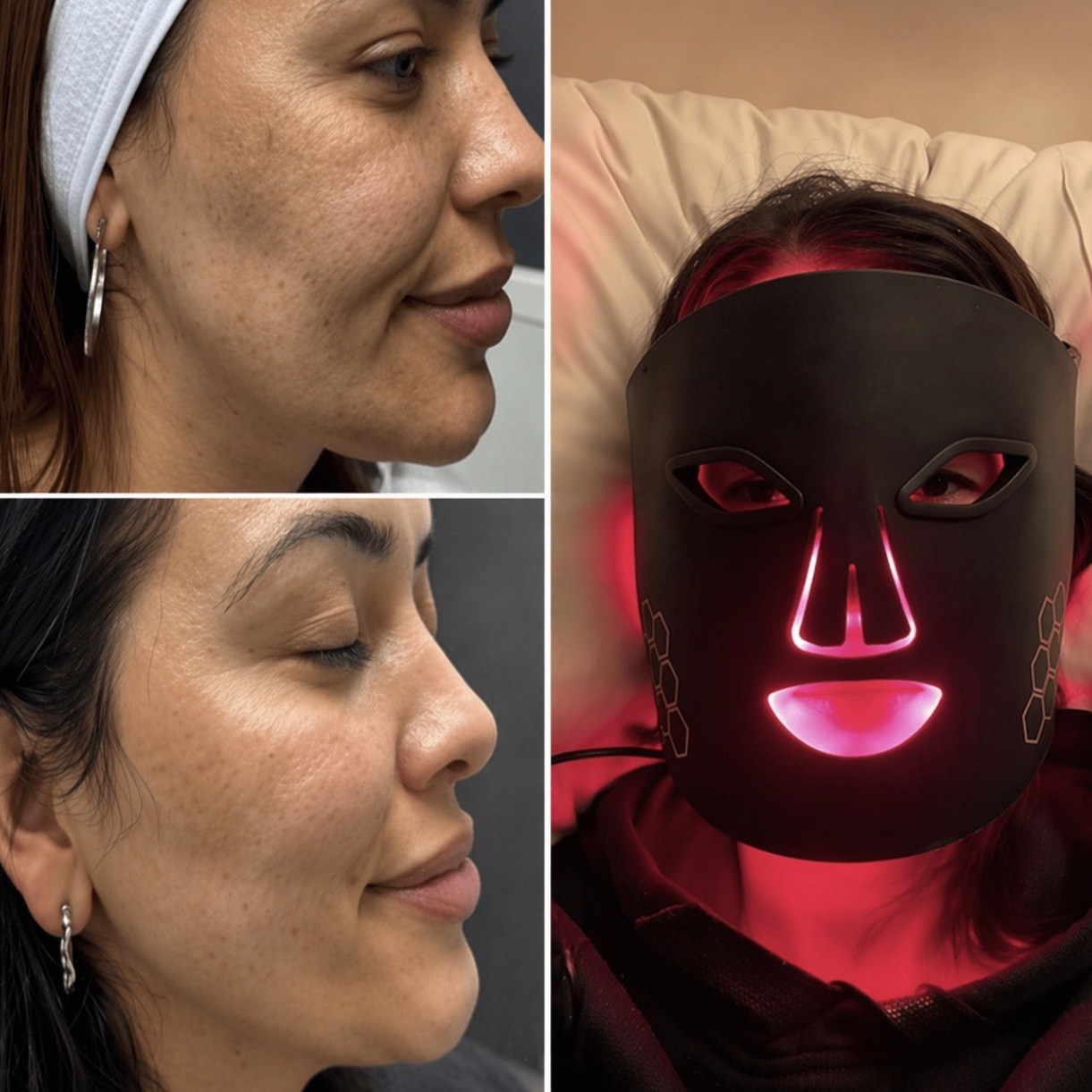 KIT Máscara LED PRO + Limpiador facial y Sérum ácido hialurónico K-BEAUTY