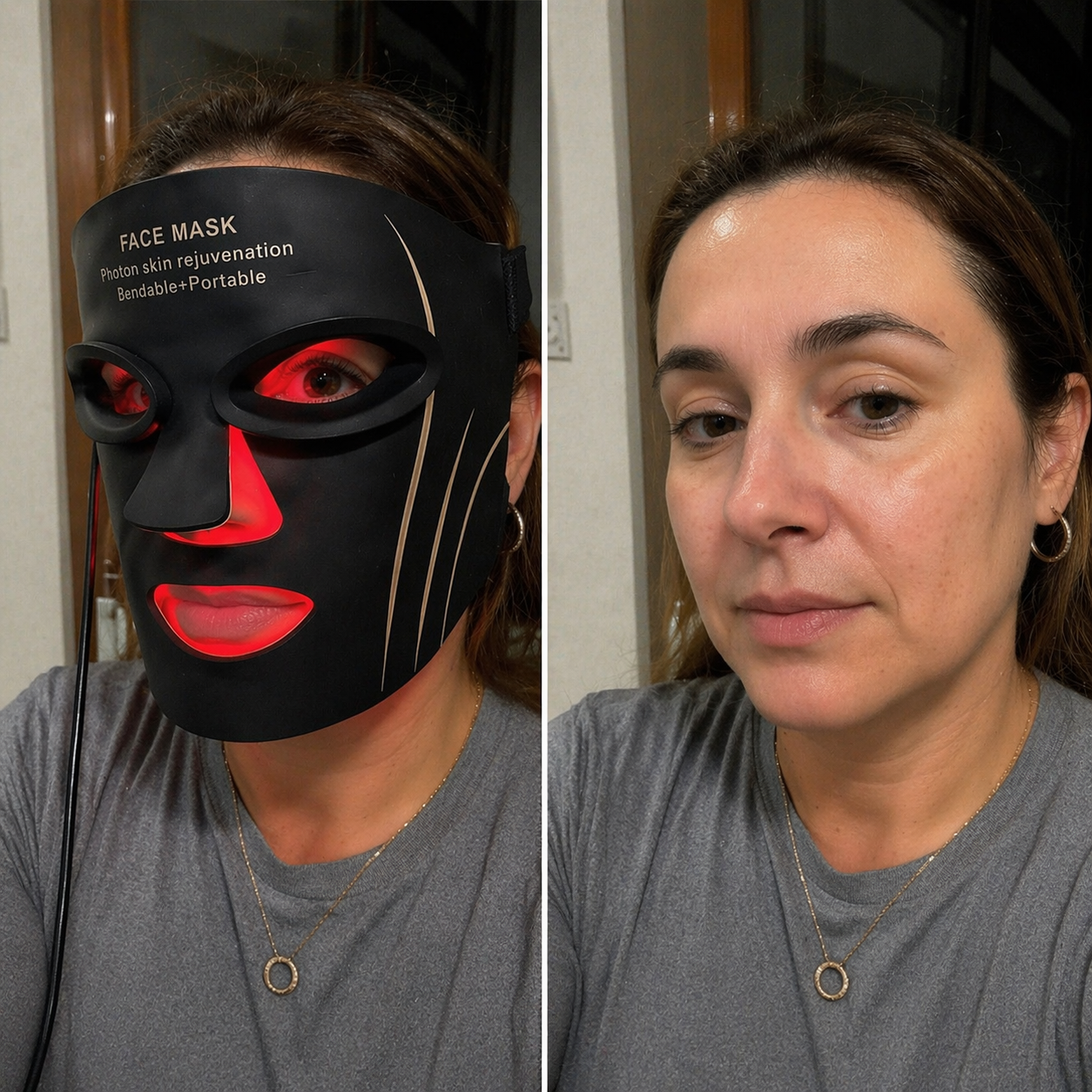 KIT Máscara led 7 colores + Limpiador facial y Sérum ácido hialurónico K-BEAUTY