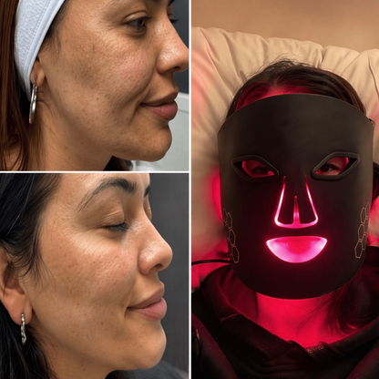 KIT Máscara LED PRO + Limpiador facial y Sérum ácido hialurónico K-BEAUTY